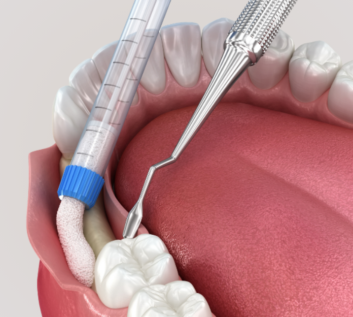 Treatments - Broad Street Dental Care