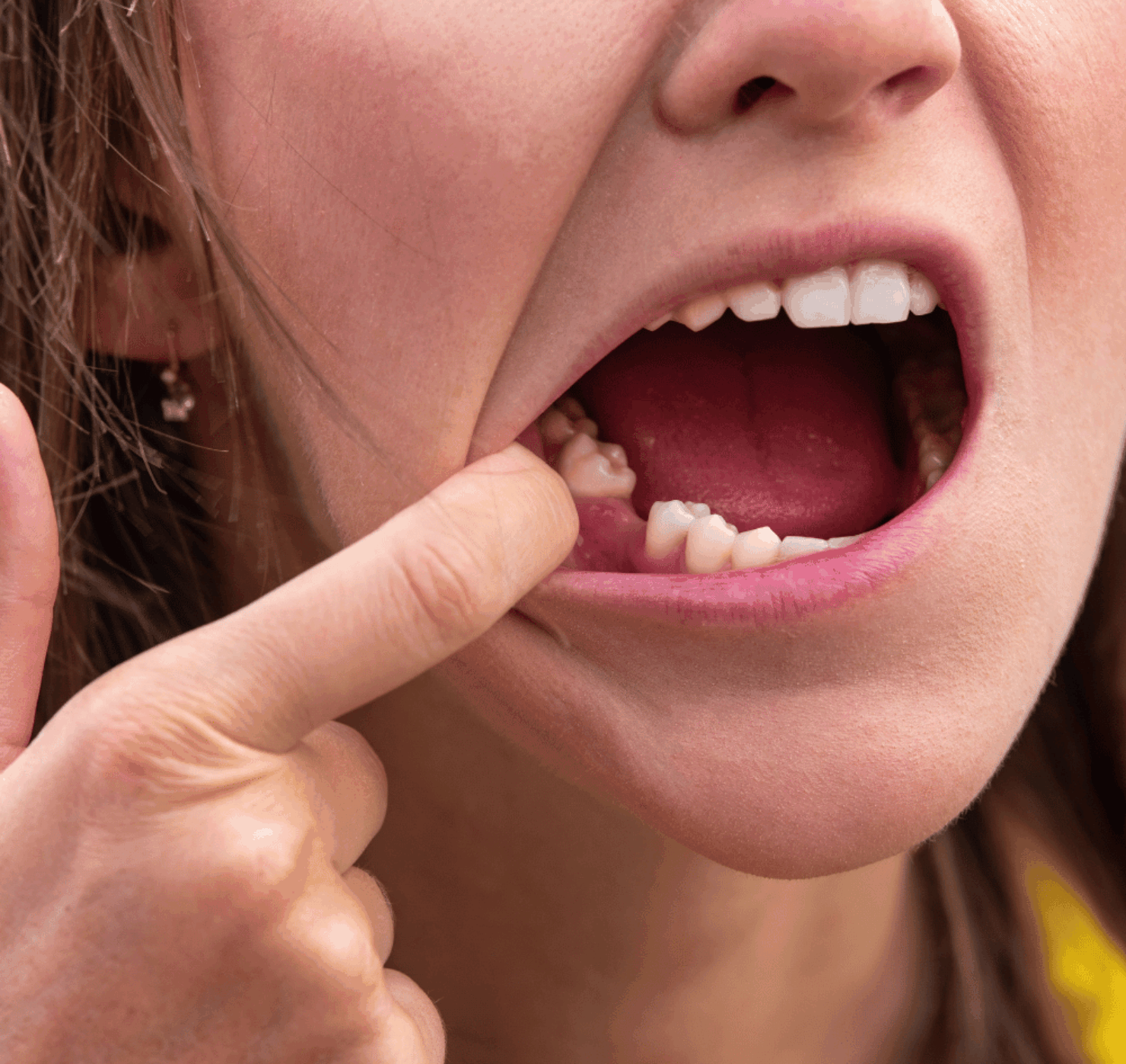 Broad Street Dental Care